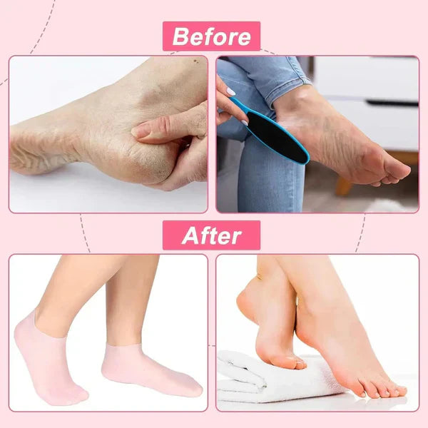 Silicon Moisturizing Gel Socks